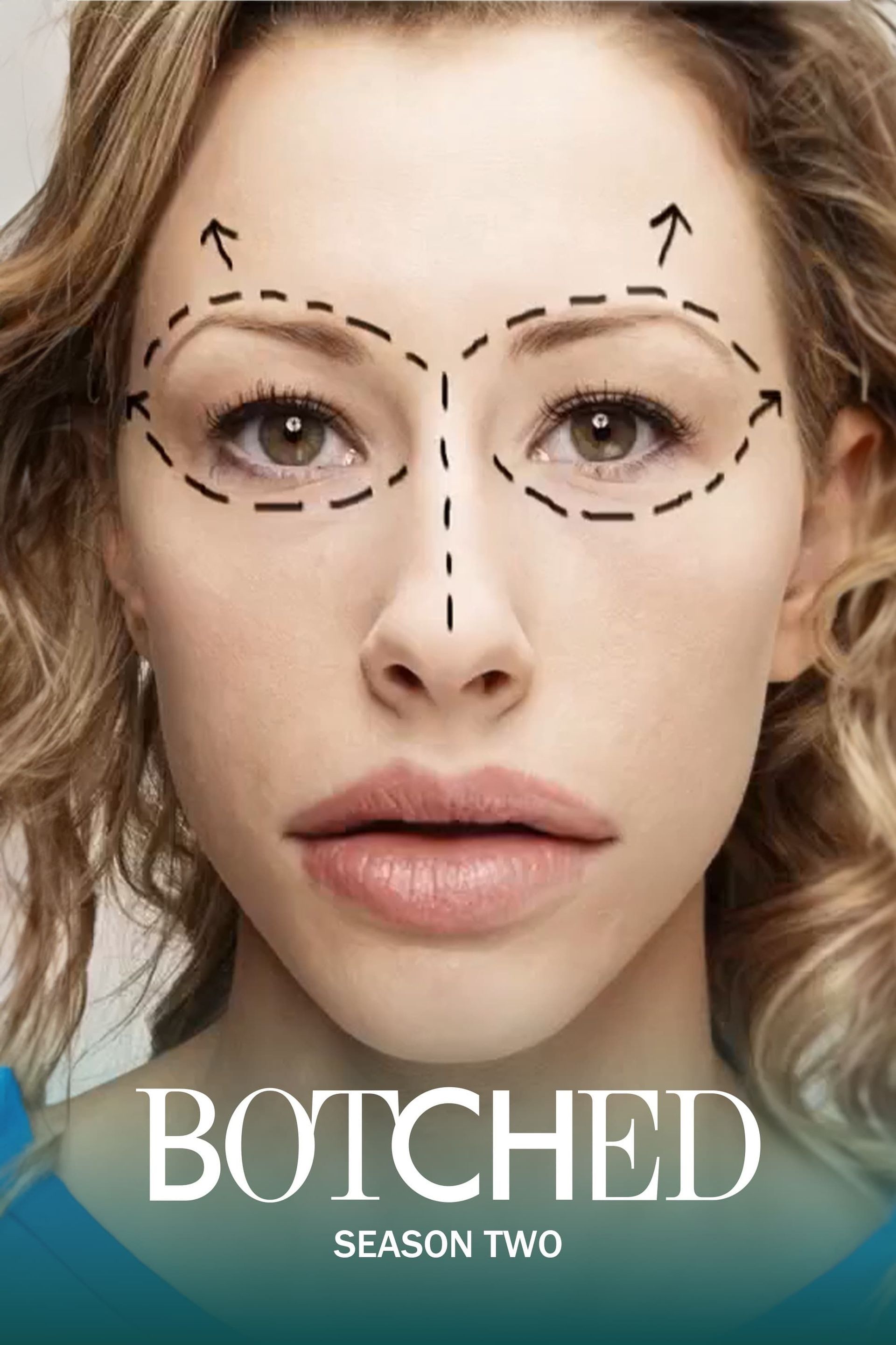 Watch Botched (2014) TV Series Free Online - Plex