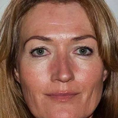 Photo of Me Foss Andersen