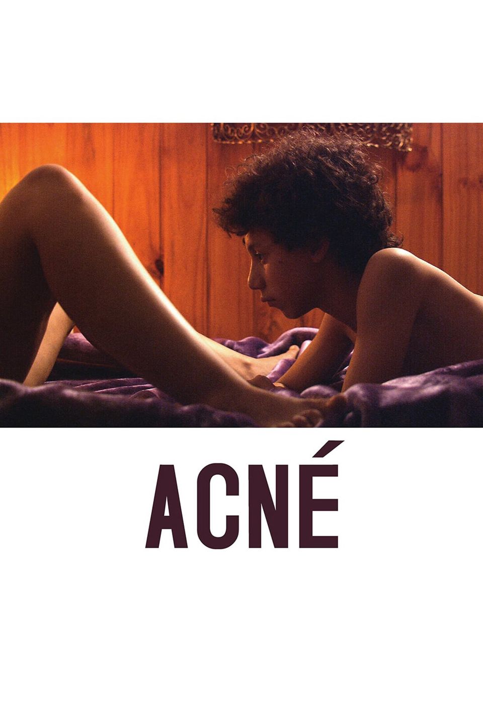 Acne (2008) - Plex